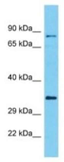 C10orf71 Rabbit anti-Human, Polyclonal, Novus Biologicals 100 &mu;g | Buy Online | Novus Biologicals | Fisher Scientific